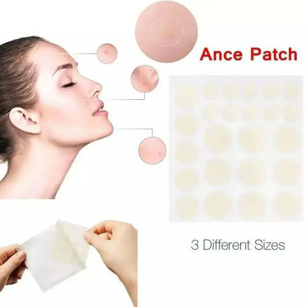 Little Stickers Patch Acne Treatment Anti-inflammatory Smoothing Makeup Invisible Acne Patch