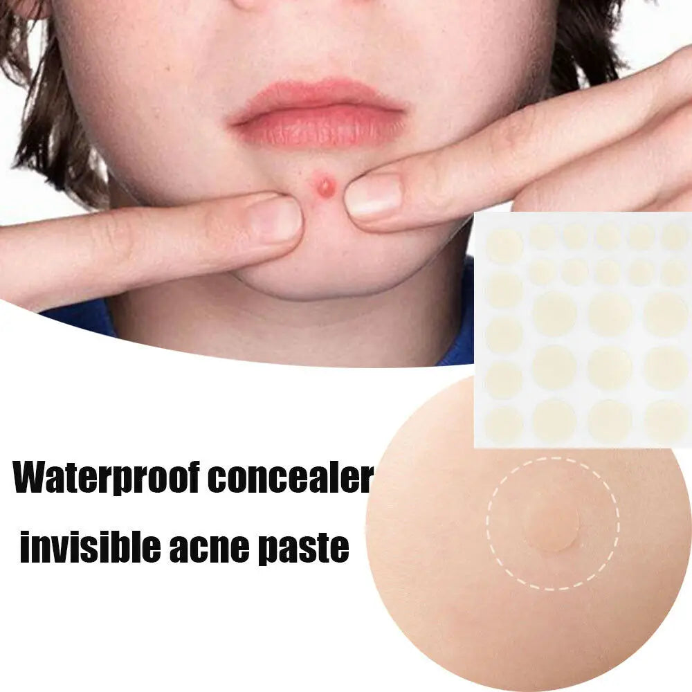 Little Stickers Patch Acne Treatment Anti-inflammatory Smoothing Makeup Invisible Acne Patch